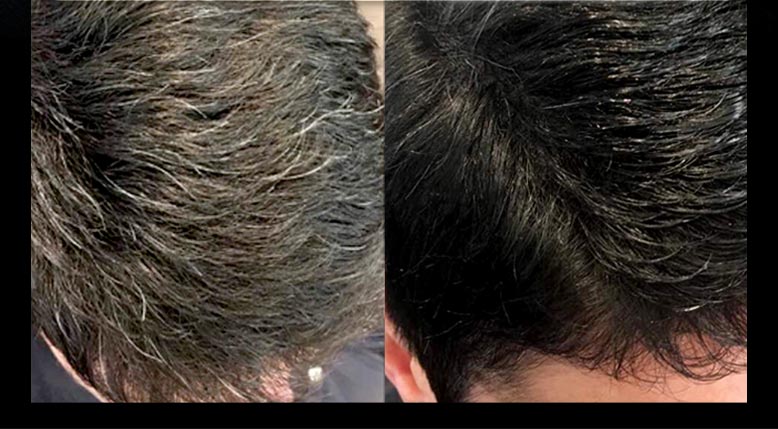 Boyasız saç koyulaştırıcı ürün Block Hair